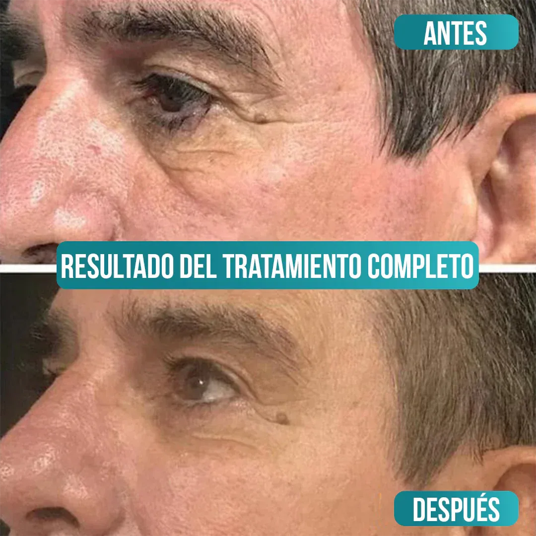 Crema Antiedad para Hombres - Sadoer Men [Vitamina C, Ácido Hialurónico + Niacinamida]